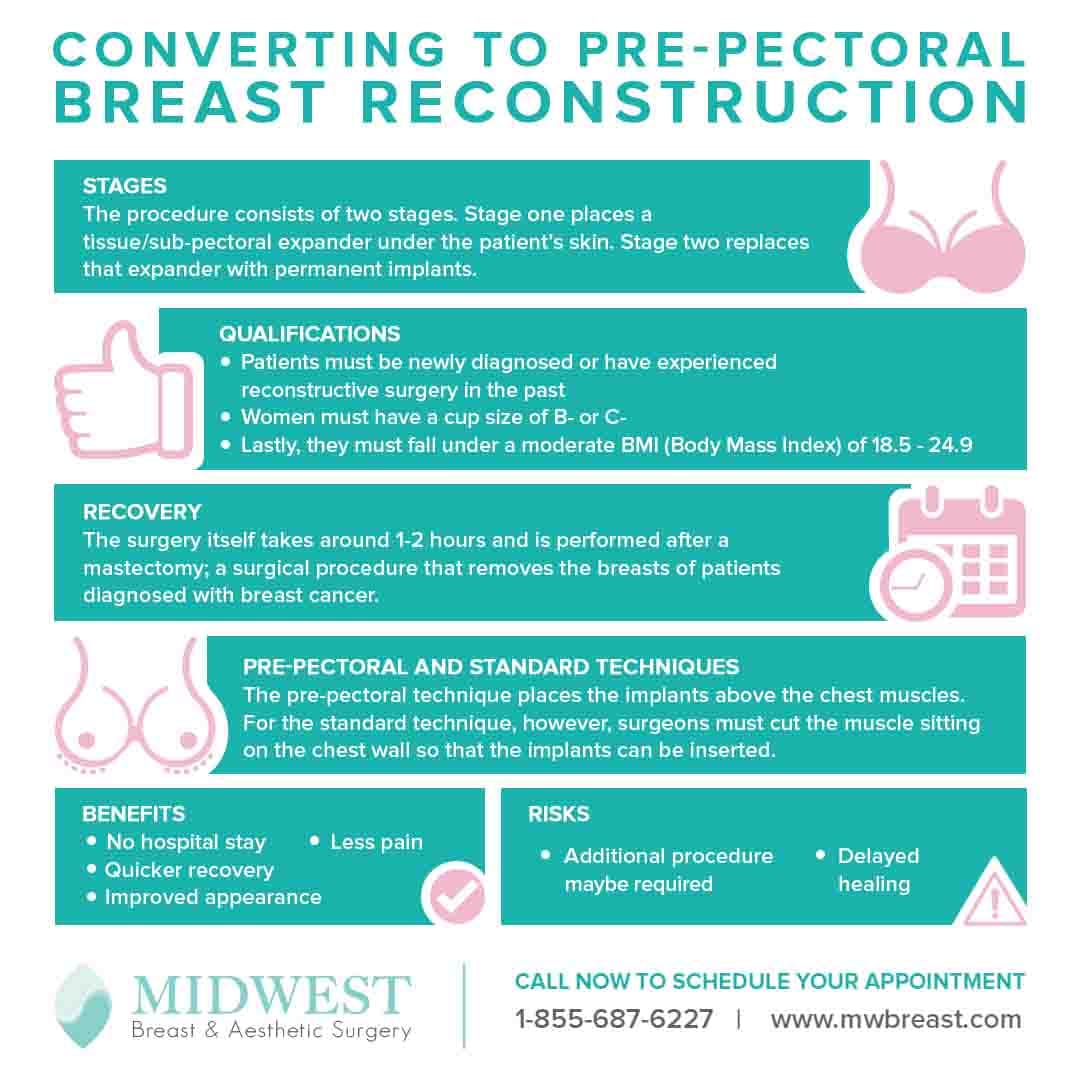 converting to prepectoral breast reconstruction infographic