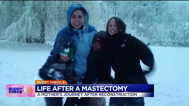 Life after a mastectomy