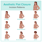 infographic about aesthetic flat closure