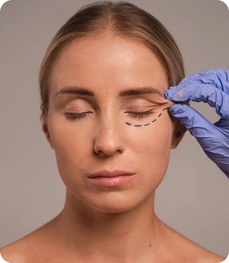 is eyelid surgery right for me